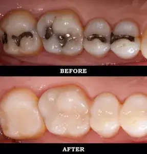 Dentista cerca de mí, dentista cerca de mí, mejor dentista de miami, mejor dentista de miami, pizza cerca de mí, chino cerca de mí, comida cerca de mí, dentista de corona en miami, dentista más barato en miami, dentista de tratamiento de conductos en miami, dentista de tratamiento de conductos en miami más barato